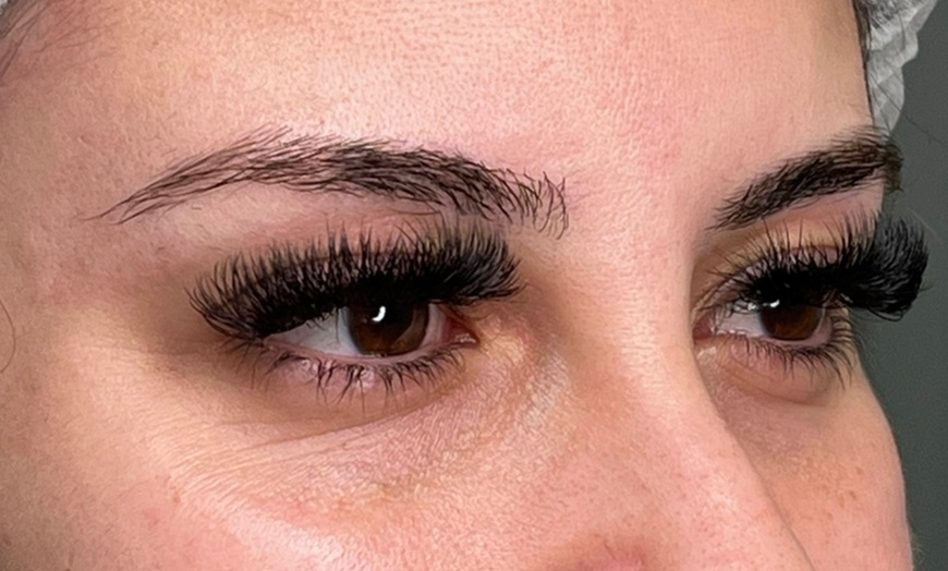 Image 7: Microblading Session with Touch Up at Elizabeth Beauty and Laser