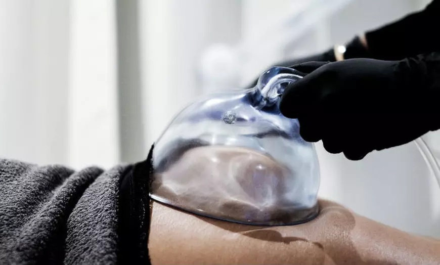 Non-Surgical Butt Lift with Mega Cup Vacuum Treatments