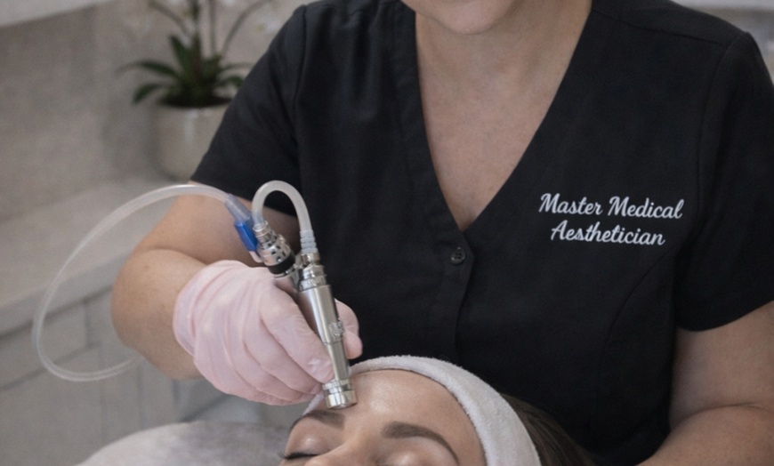 Image 2: Facial IPL Photo for Smoother Skin