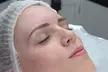 One Session of Microblading at Skincraft Aesthetics - Image 2
