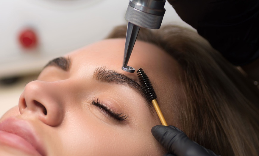 Image 1: Eliminación de microblading en cejas en Estética 360