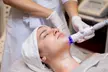 Higiene facial completa con tratamiento y opción a radiofrecuencia y presoterapia corporal, con hasta un 84% - Second Medium