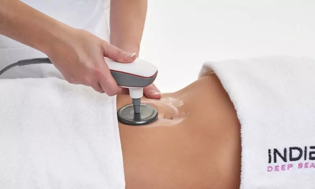 Radiofrecuencia facial o corporal en Raquel Gallardo Alarcón