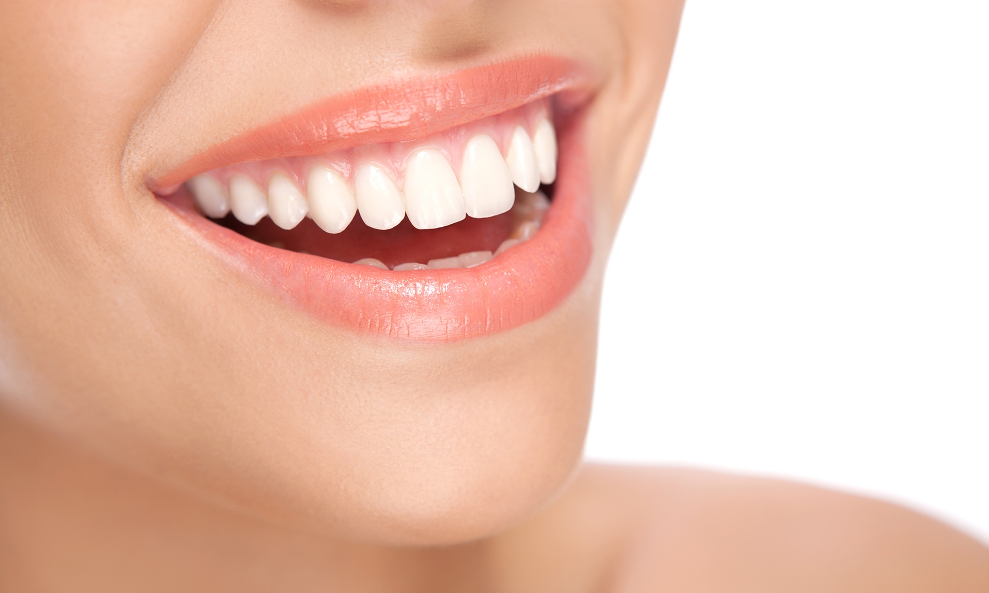 Blanqueamiento dental led con limpieza y fluorización, 1 o 2 sesiones