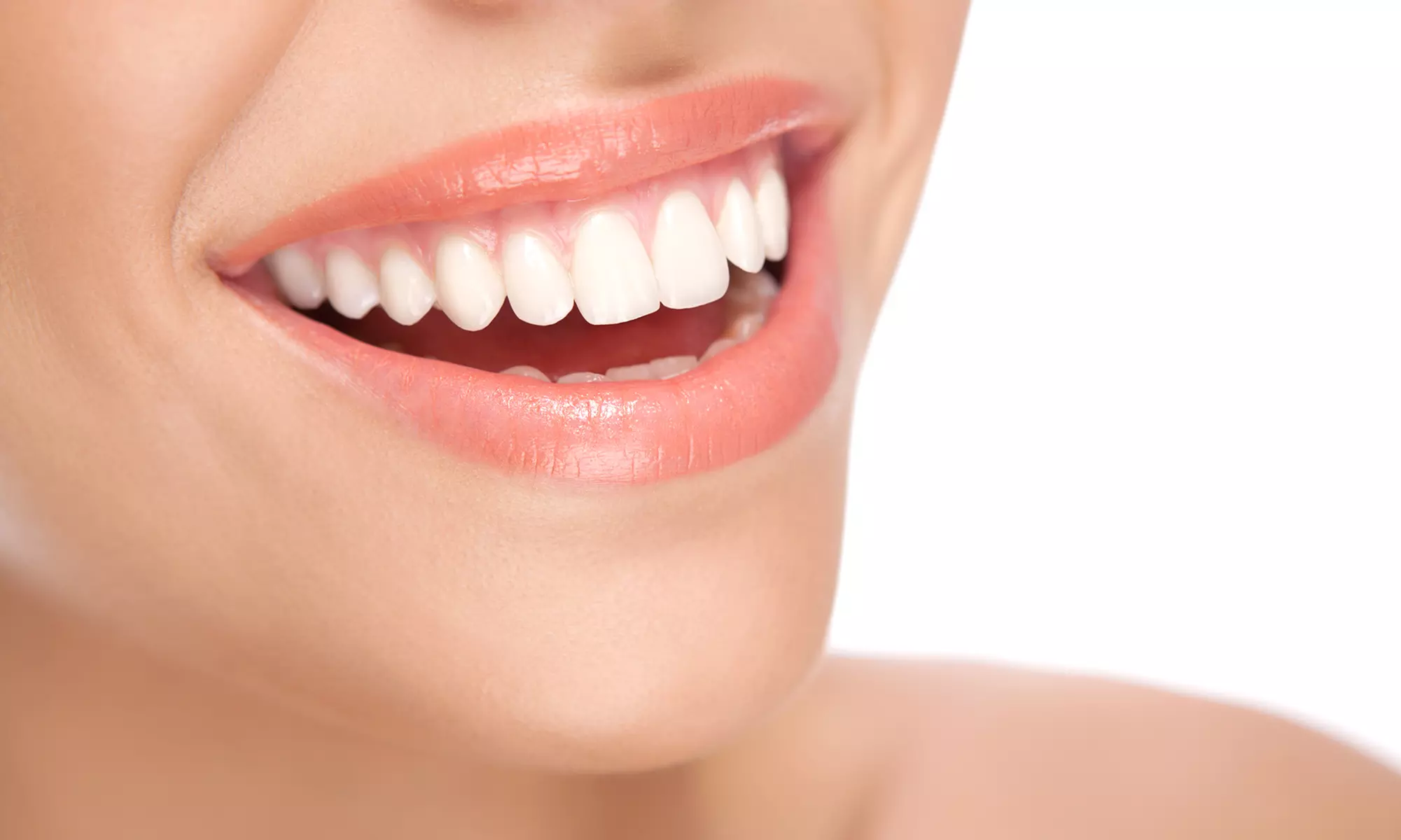 Blanqueamiento dental led con limpieza y fluorización, 1 o 2 sesiones