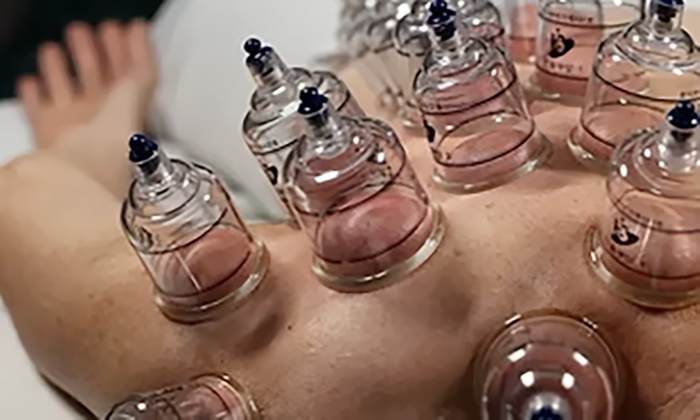 Enhance Mobility with Range of Motion or Myofascial Release Cupping