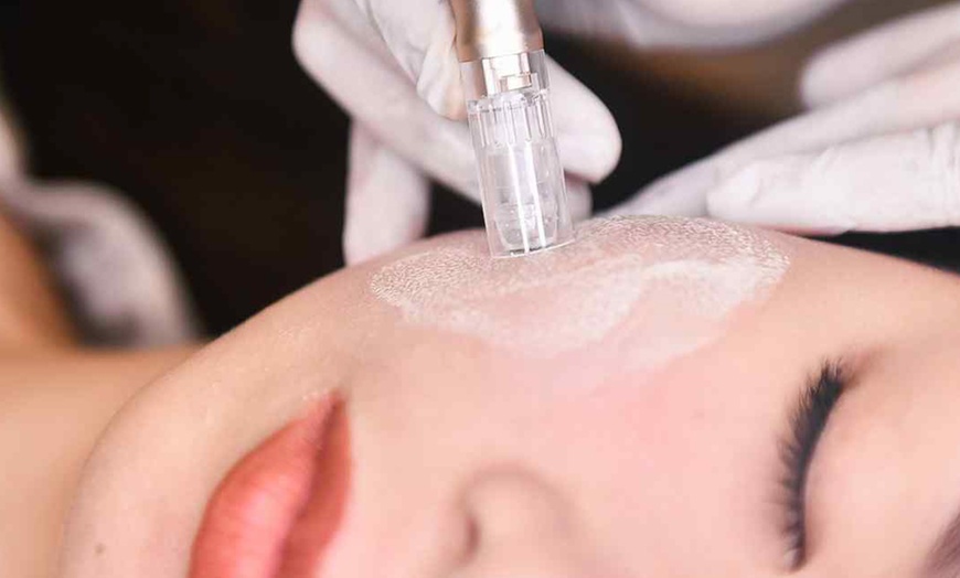 Image 2: Anti-Wrinkle Mesotherapy Facial