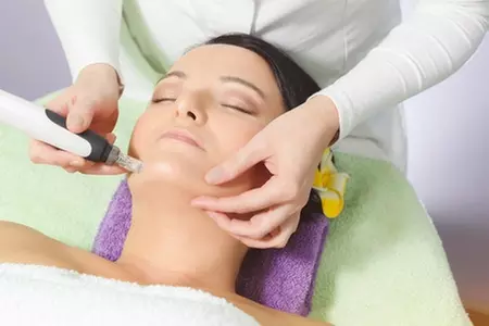 Brunswick Medi Spa offers microneedling treatments, enhancing skin up to 67% with one, three, or six sessions. - Primary Image