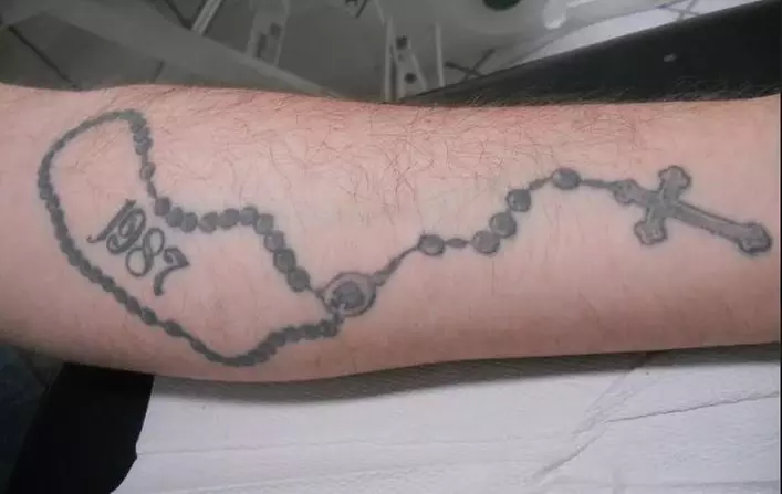 Wertgutschein Tattoo-Entfernung