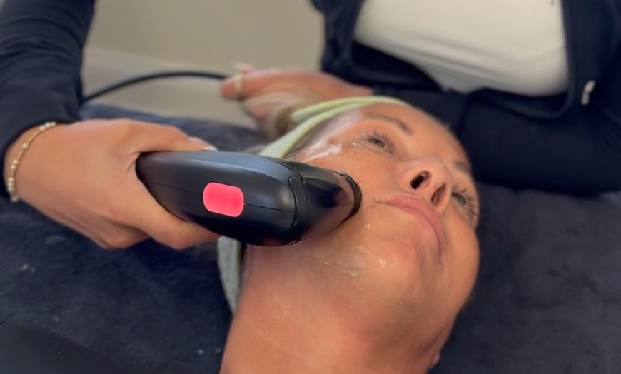 Image 1: Up to 87% Off on Facelift - Non-Surgical at Luxe Renewal Wellness Spa