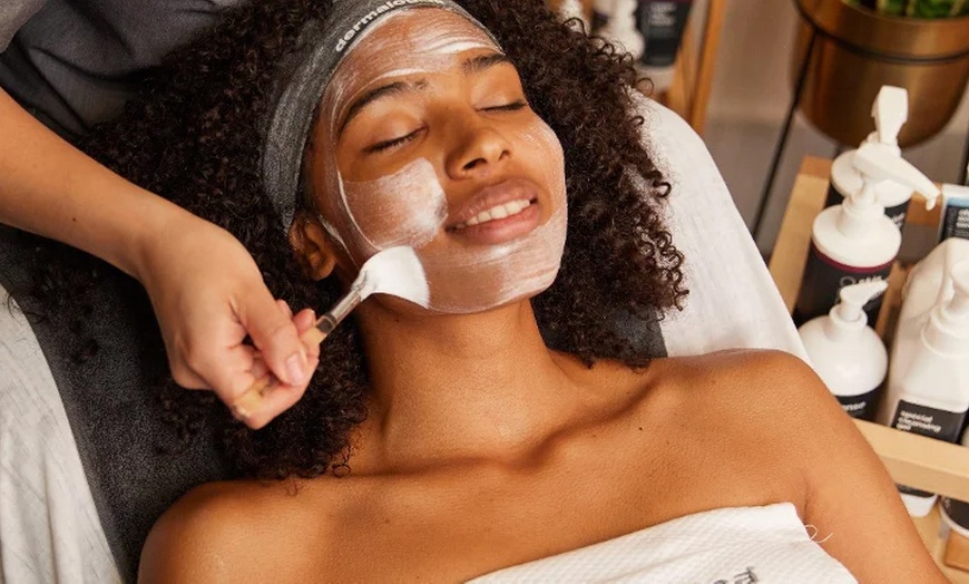 Image 8: Microneedling et peeling d'1h