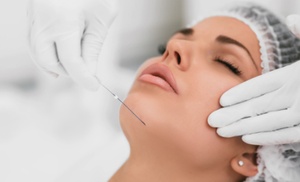 PDO Thread Non-Surgical Facelift for Face, Jaw Line, Neck & More