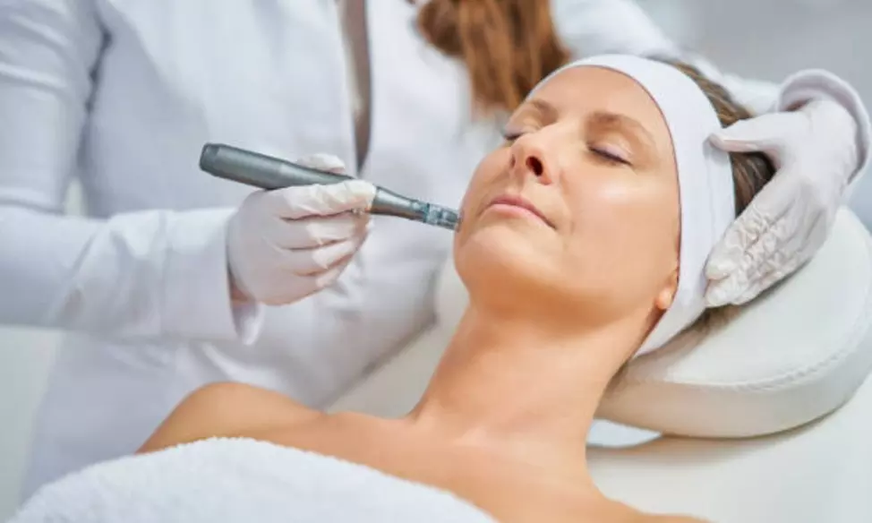 Dermapen facial con opción a cóctel de vitaminas y máscara led