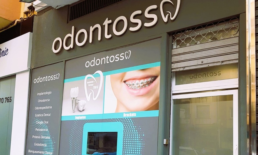 Image 4: Blanqueamiento dental con led en Clínica Dental Odontoss