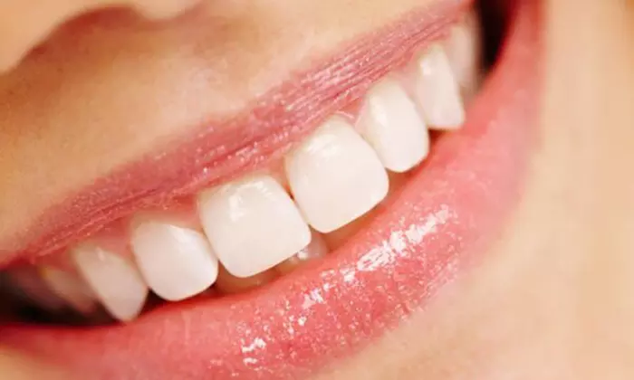 ***Price Drop*** - Advanced Teeth Whitening Treatment with take home trays @ Aesthetics Medical Clinic (up to 85% off) - Primary Image