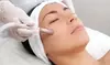 One or Two Diamond Microdermabrasion Treatments w/ LED Light Therapy at Pink Diamond Spa (Up to 46% Off)