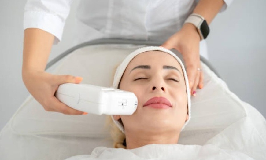 Image 4: HIFU 7D facial o corporal con zona a elegir o rostro completo y cuello