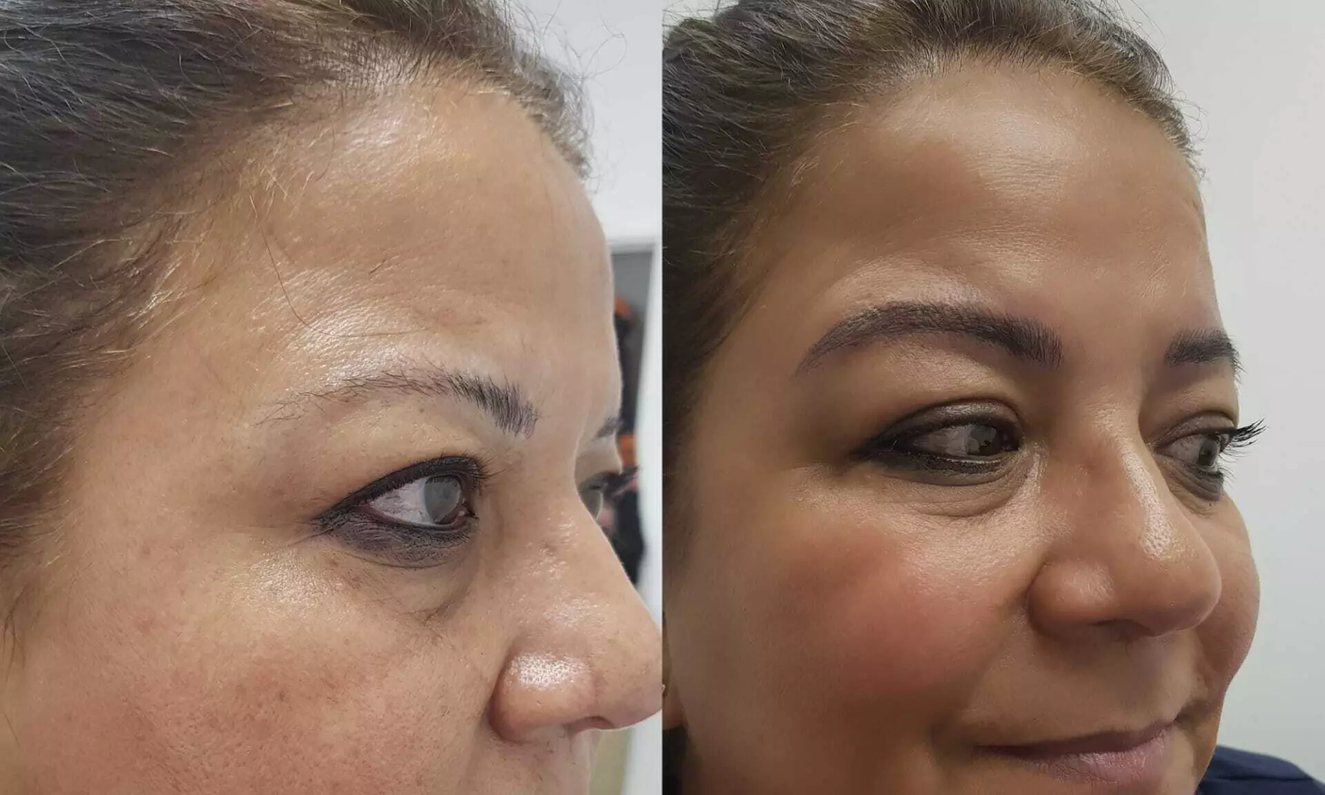 Radiant Skin with One or Three Sessions of Glass Skin Facial Treatment or Glass Facial Treatment (Up To 44% Off) - Image 3