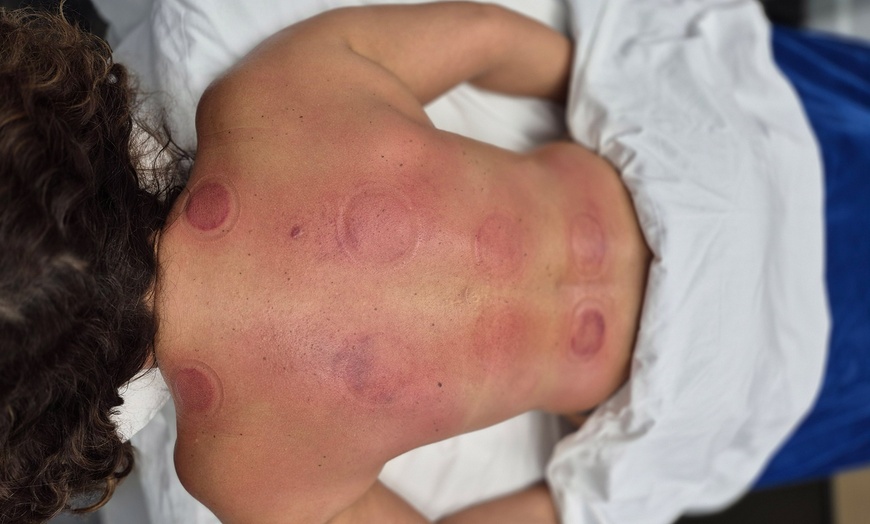 Image 4: Indulge in a 60-Minute Cupping or Manual Lymphatic Drainage Massage