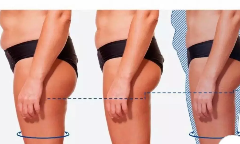 Relaxing body wrap sessions for wellness and rejuvenation