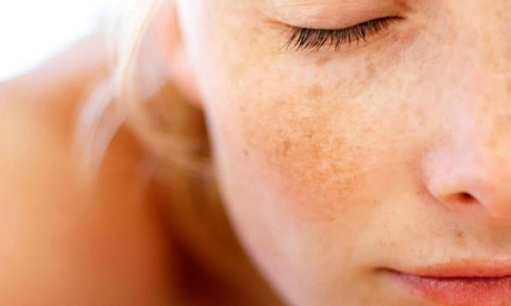 Sedute laser QS per la riduzione delle macchie scure della pelle o rimozione tatuaggi (sconto fino a 78%)