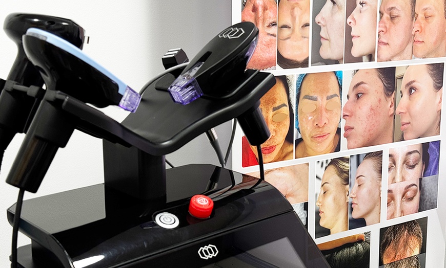 Image 4: Brighten Dull Skin with One or Two Custom Chemical Peels