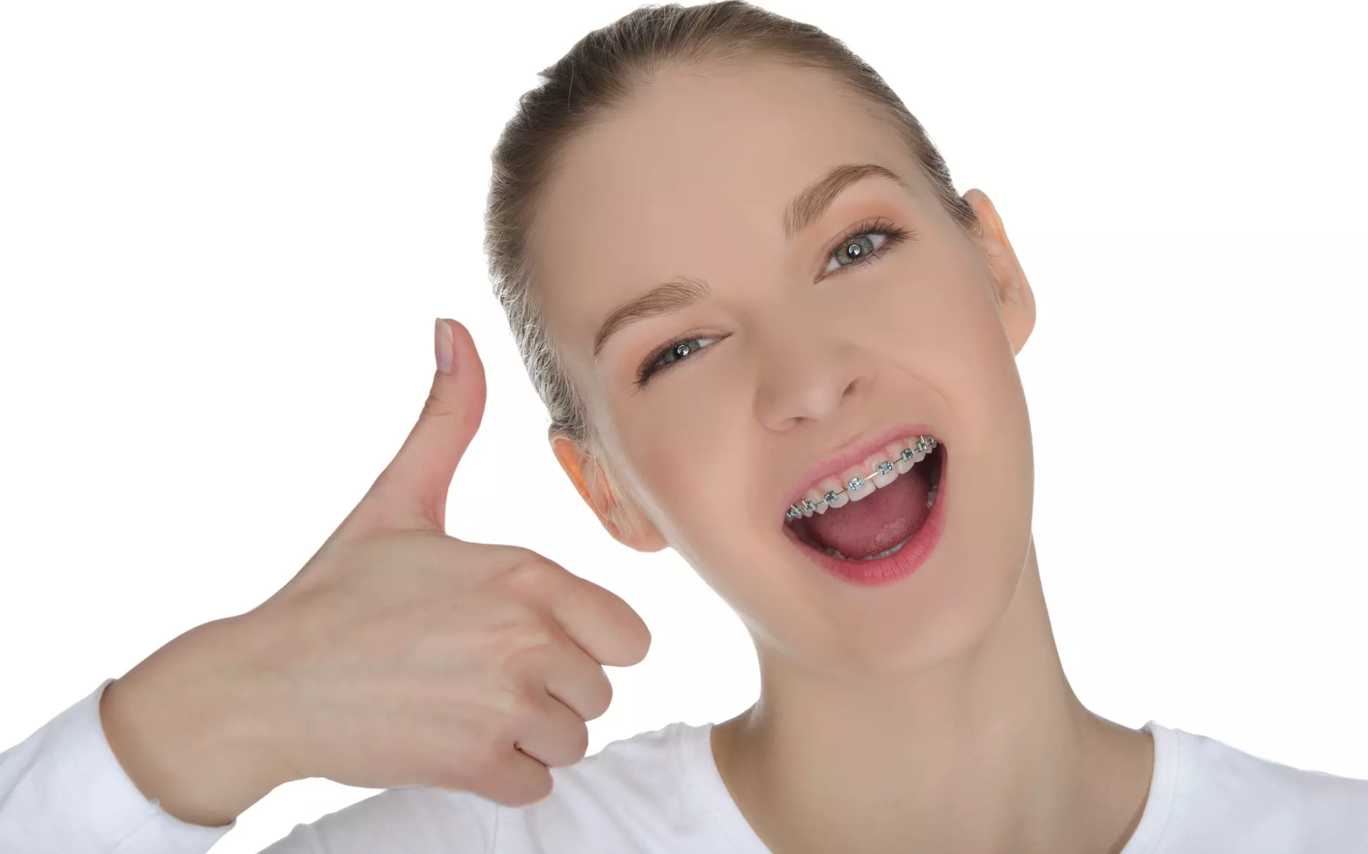 Transform Smiles at CaliSmile Orthodontics With $2,000 Off Braces or Invisalign - Primary Image