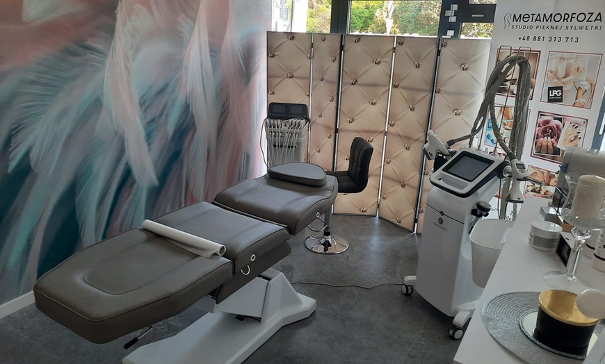 Image 4: Endermologia® na całe ciało, endermolift twarzy i mikrodermabrazja 