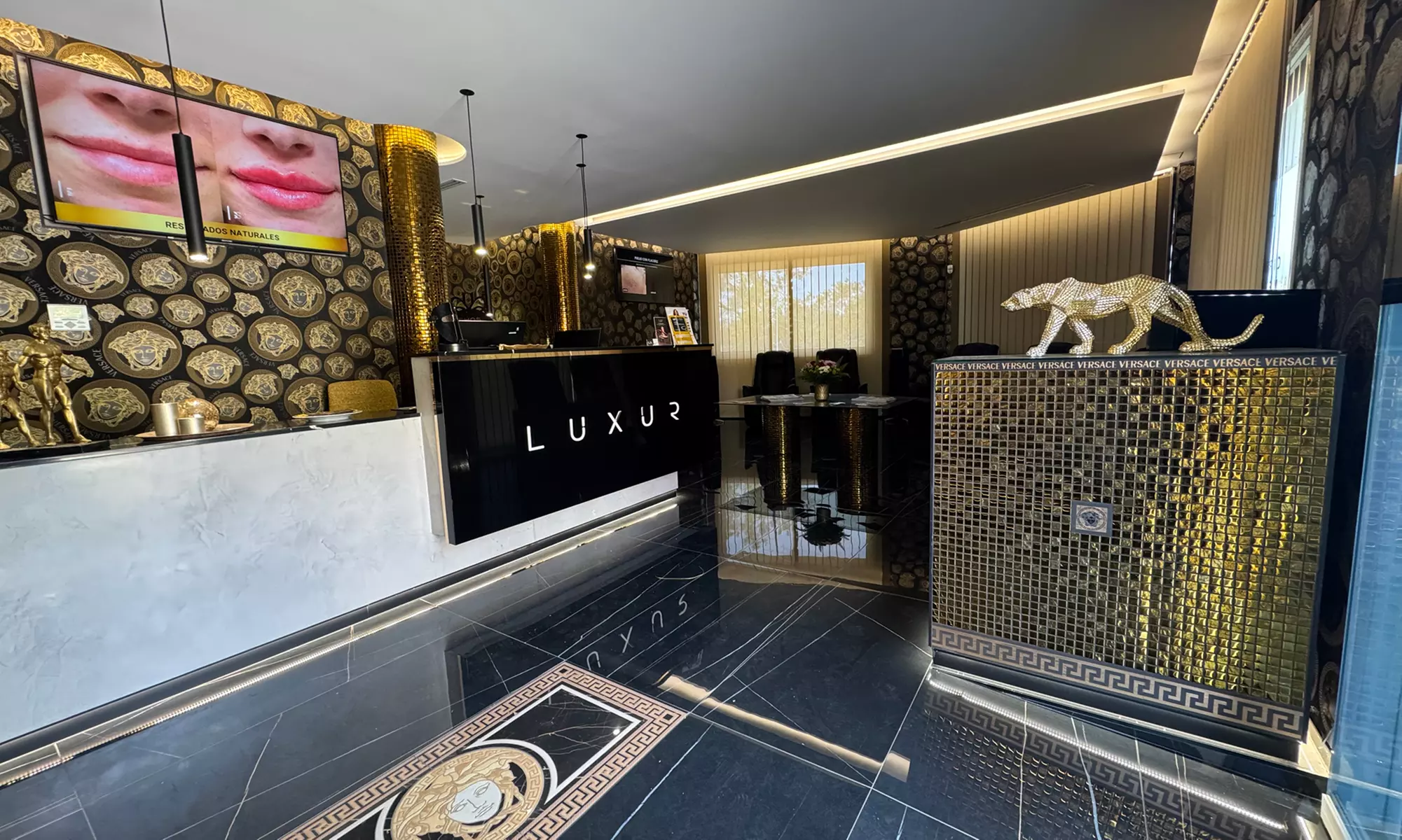 Limpieza bucal, fluorización y opción a férula de descarga semirrígida