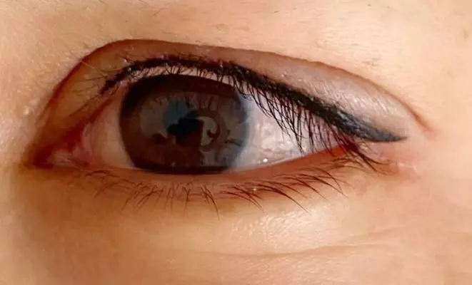 2,5 Std. Wimpernkranzverdichtung oder Baby Liner inkl. Nachbehandlung