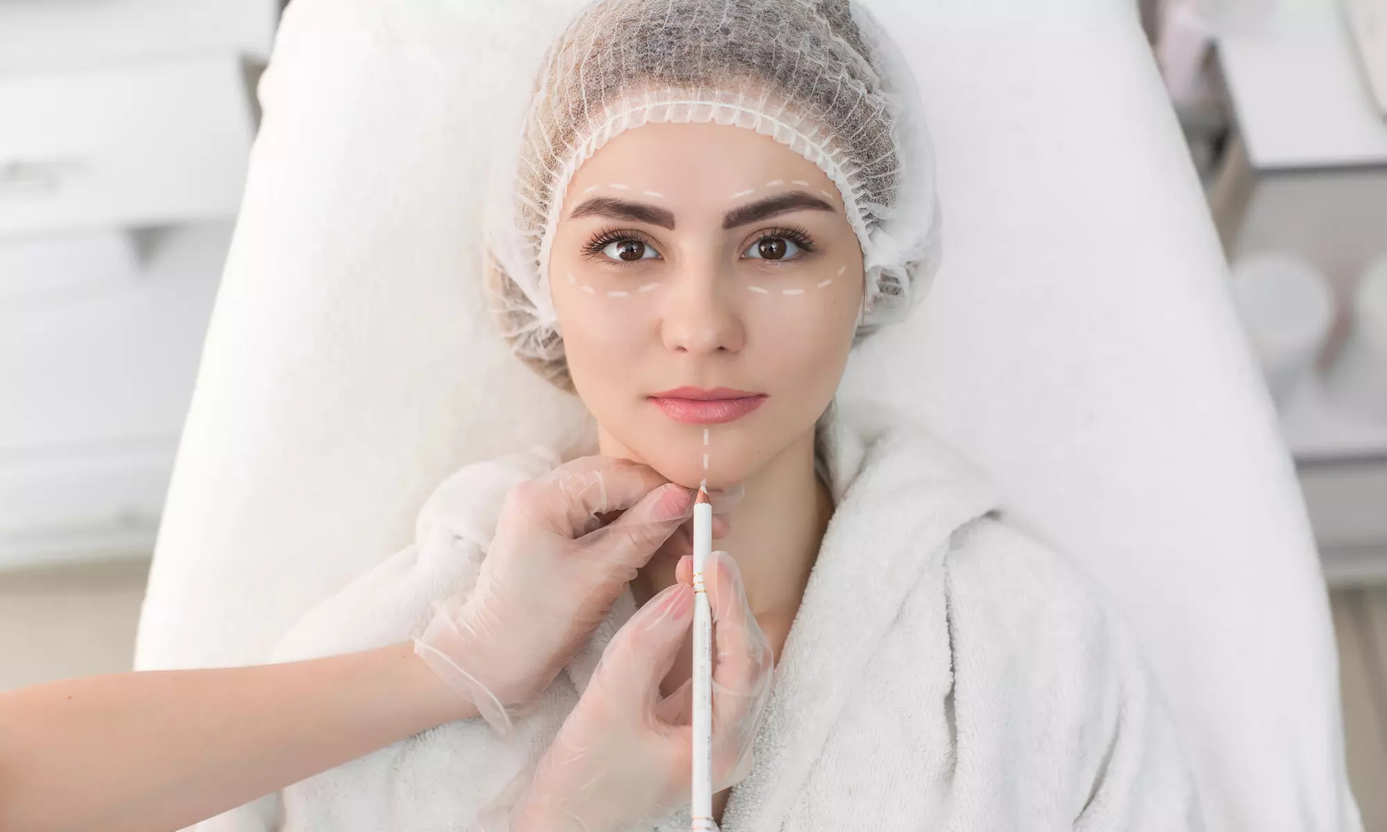 Wertgutschein über bis zu 149 € für eine Fadenlifting-Behandlung mit bis zu 12 Monofäden in der SB clinic - Primary Image