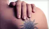 $239 for Four Same-Day Tattoo-Removal Sessions at Clearstone Laser Hair Removal & Medical Spa ($600 Value)