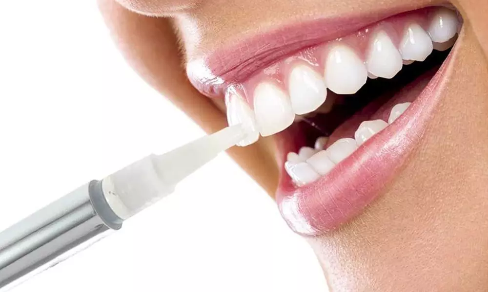 DentaPro 2000 Professional Teeth Whitening Pens (3-Pack) - Second Medium