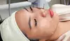 1 or 2 HIFU Sessions for Full Face or Face + Neck Lift at Gisela Andrade Beauty Spa Up To   71% Off