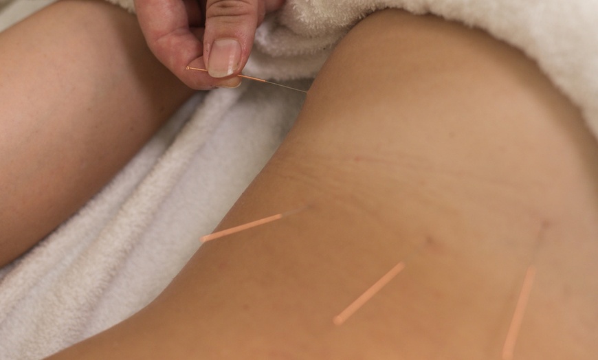 Image 5: 60-Minutes or 90-Minutes Remedial Massage Treatment with Consultation