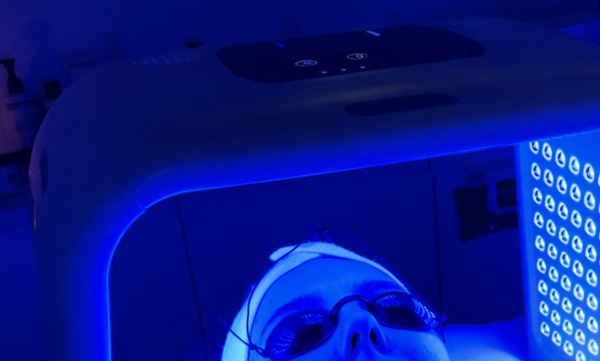 Image 4: Up to 60% Off on Facial - HydraFacial at Kolcheva Skin and Laser clinic