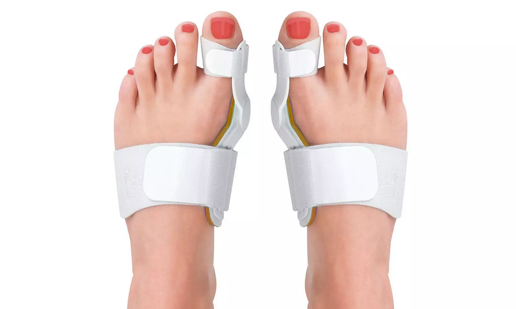 Medical-Grade Adjustable Bunion Toe Splint with Hinge (1-Pair) - Primary Image
