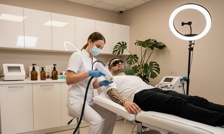 Small: Three session of tattoo removal - Dolls Aesthetics Academy