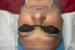 Up to 50% Off on Men's Facial at Blossom Beauty Skincare - Second Medium