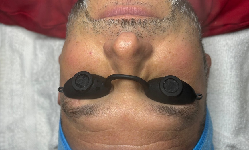 Image 5: Up to 50% Off on Men's Facial at Blossom Beauty Skincare
