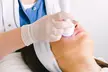 Limpieza con radiofrecuencia, paleta ultrasónica, máscara led o dermapen en cara o labios en Estética Avanzada Ferreiros - Second Medium