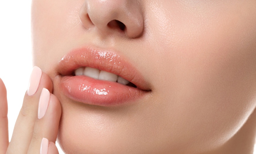 Image 4: Mesotherapy for Lip Volume at Miami Kiss