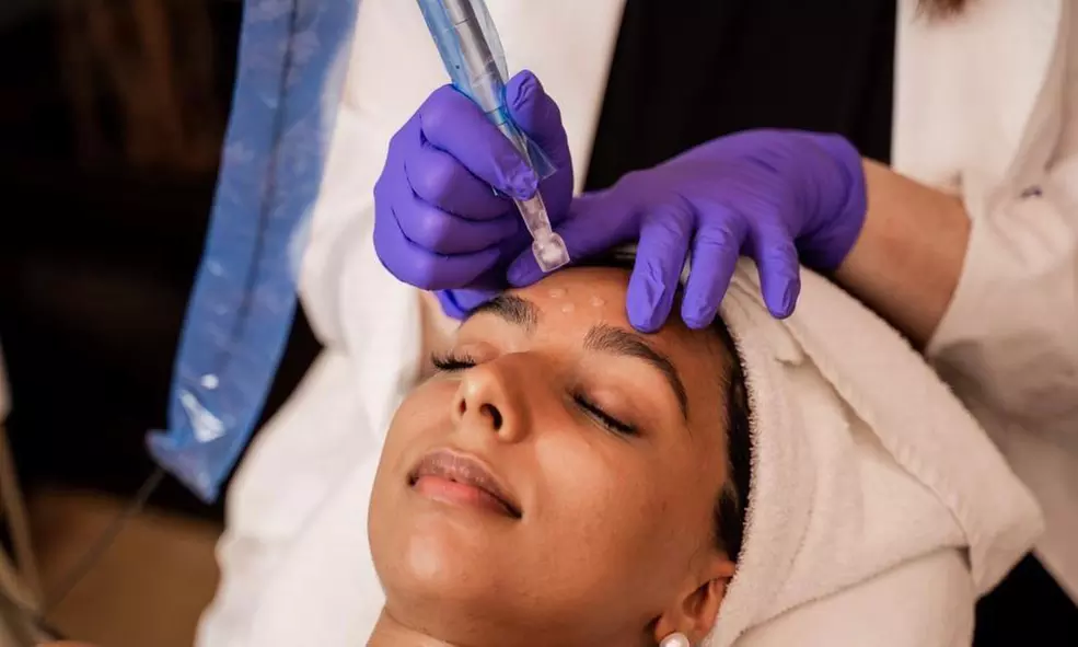 One Microneedling Treatment OR One HydraFacial Keravive Scalp Treatment at Marigold Skin Lab (Up to 42% Off) - Second Medium