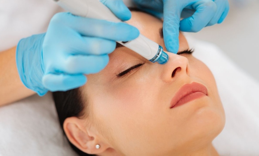 Image 1: Hydrafacial con peeling natural