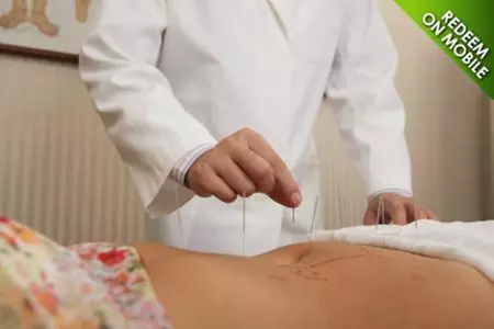 Acupuncture for Wellness and Abdomen Tightening