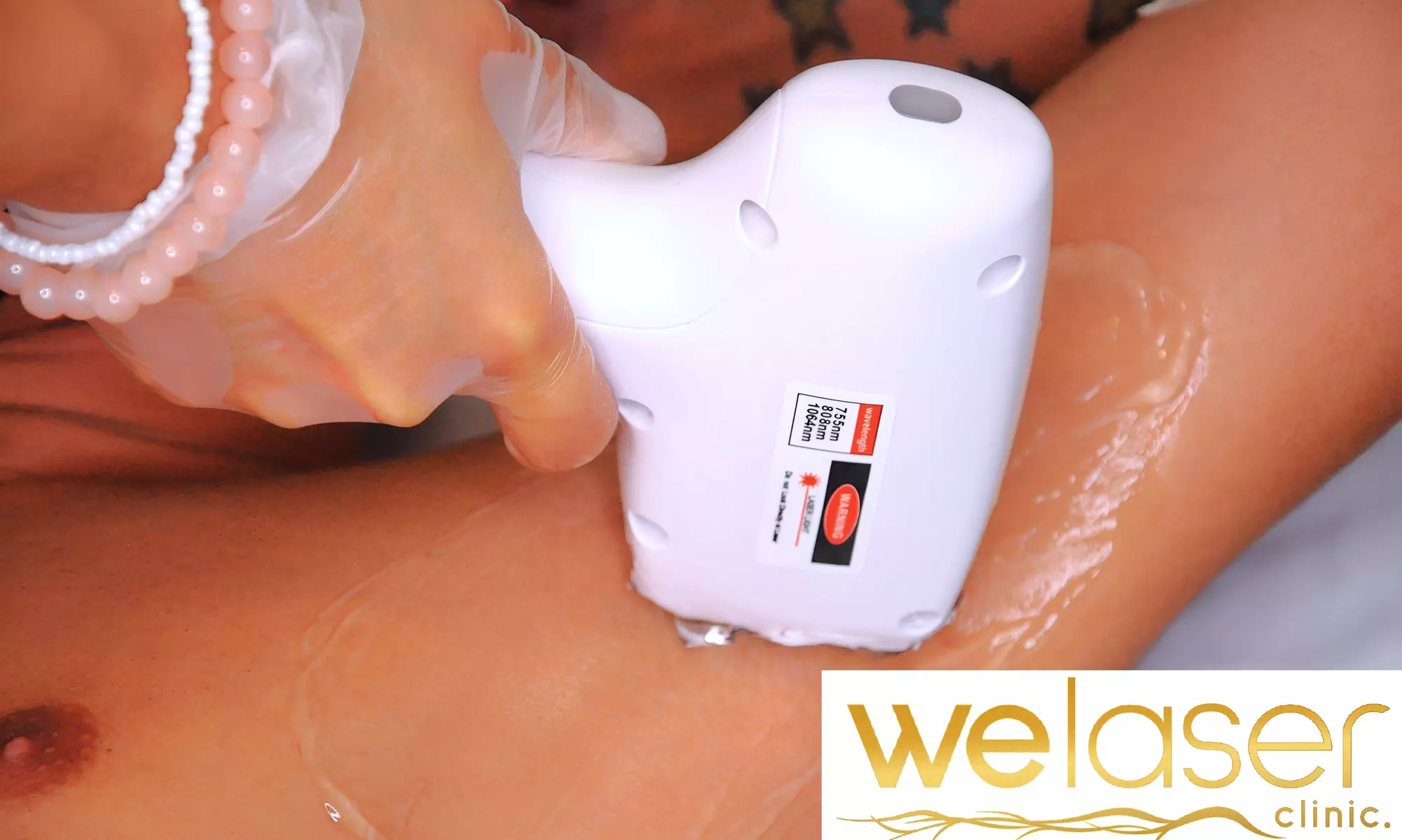 Up to 81% Off on Laser Hair Removal at We Laser Clinic