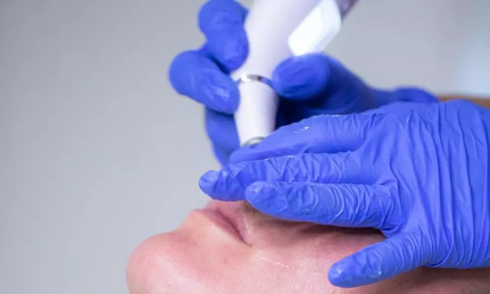 3, 6 o 9 sesiones de tratamiento facial a elegir en The Look Madrid