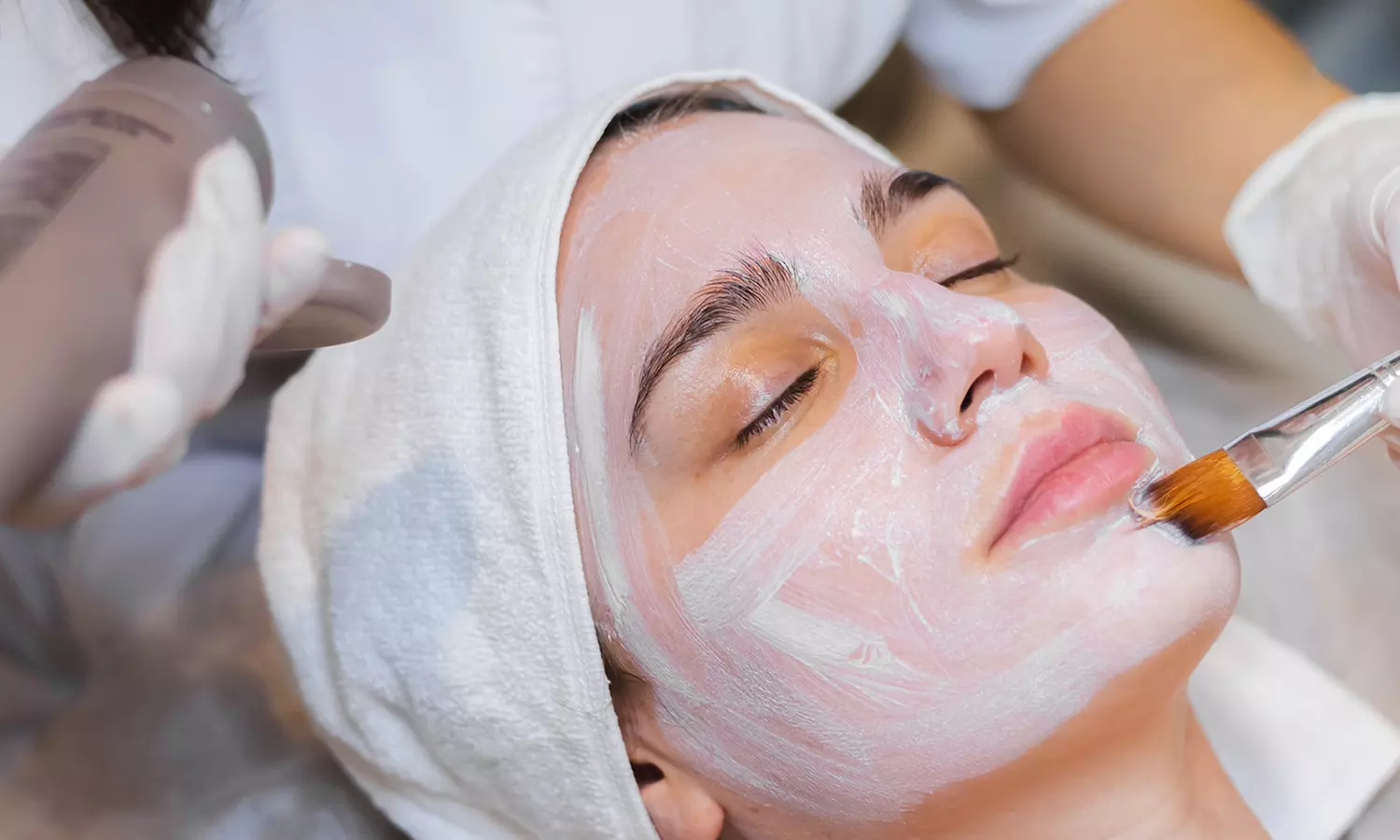 Skin Peel treatment at Miami Kiss