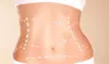 1, 2, or 3 Cellulite and Body Contouring Treatments at NuYu Vitality Med Spa & Laser Clinic (Up to 66% Off)