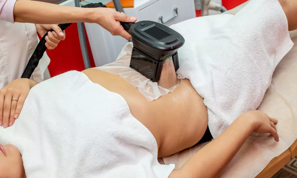 Cryolipolysis Fat Freezing at Miami Kiss